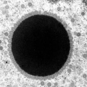 TEM image shows a sun-shaped area in turtle cells where ChHV5 replicates. Credit: Thierry Work, USGS.